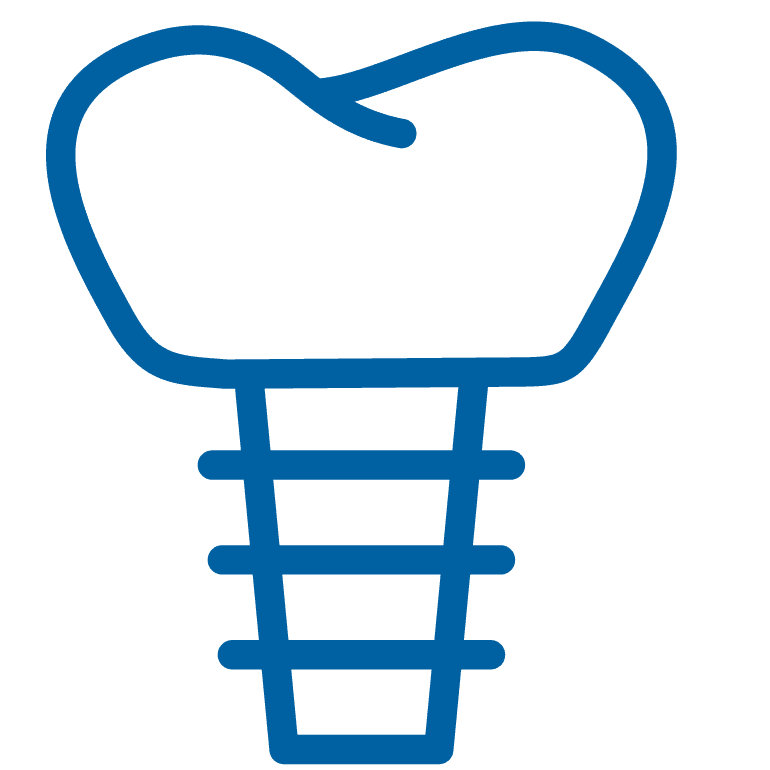 Implantes <br> Dentales
